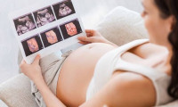 怀孕早期B超孕囊数据越大生男孩几率是不是就越高?