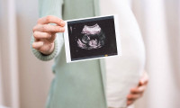 怀孕最早多久能看出男女？
